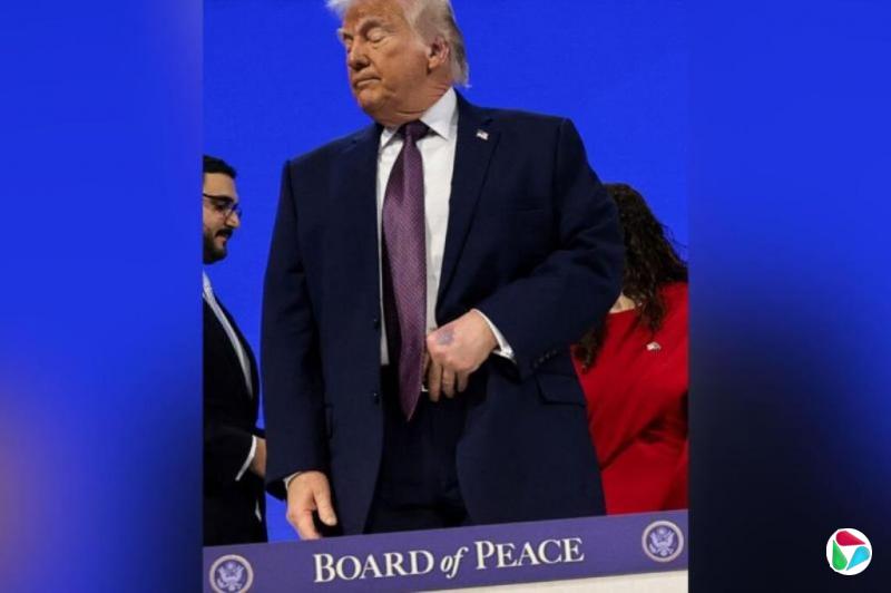 特朗普左手淤青引健康关注