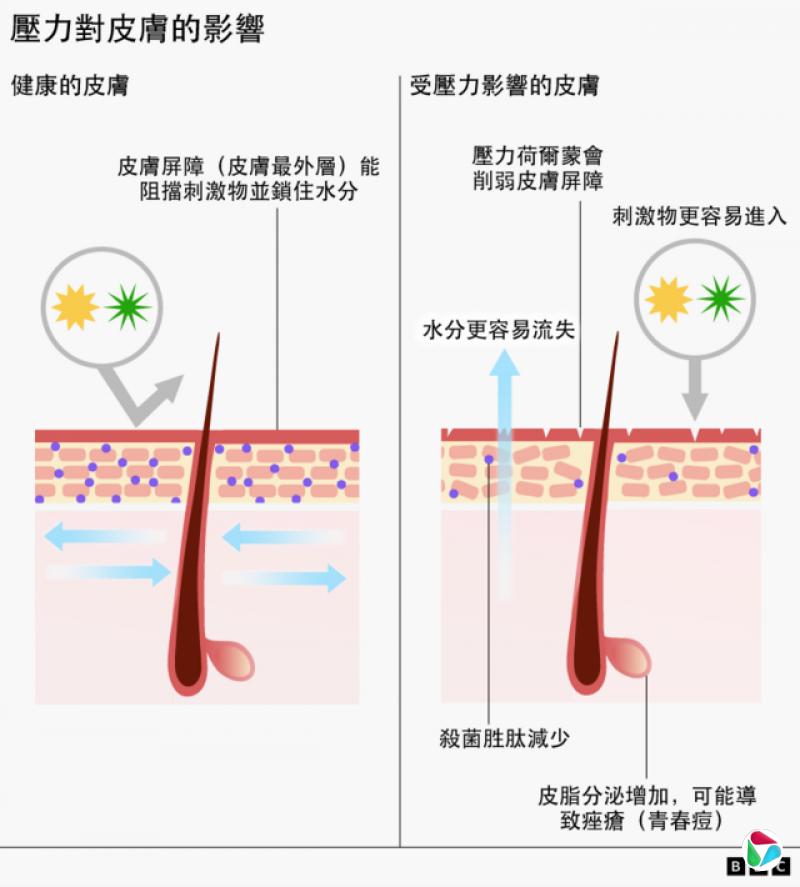压力对皮肤影响图解
